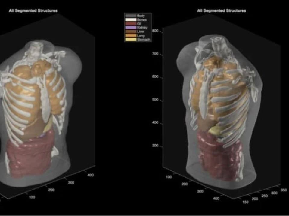 Midjourney lance un scanner médical à ultrasons pour imager tout le corps en 60 secondes